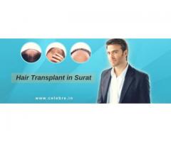 Hair Transplant in Surat