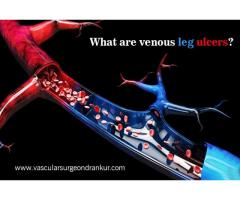 What are venous leg ulcers