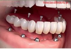 Manohar dental care best root canal doctor in vizag