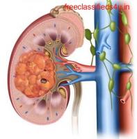  What are the different kinds of kidney stone