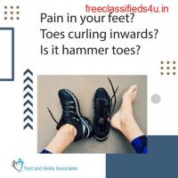Pain in your feet? Toes curling inwards? Is it hammer toes?