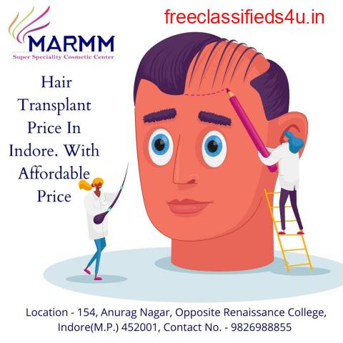 Hair Transplant Price In Indore. With Affordable Price
