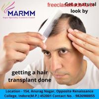 Get A Natural Look By Getting A Hair Transplant Done