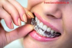 Invisible Braces Treatment - Best Dentist In Bangalore - My Dentist 
