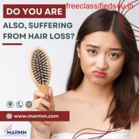 Do You Are Also Suffering From Hair Loss?