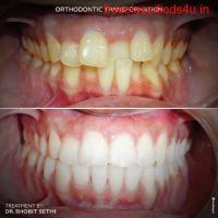 Best Dentist Chandigarh, Best Dental Clinic in Chandigarh