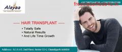 What is Bio FUE hair Transplants in Chandigarh