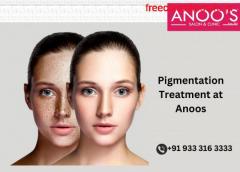 Advanced Pigmentation Treatment at Anoos